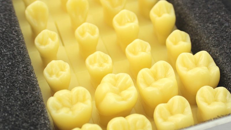 成都补牙材料怎么选？3M材料选购指南**